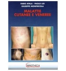 MALATTIE CUTANEE E VENEREE